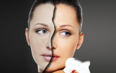 簡單的祛痘方法，讓你的皮膚時刻光滑細嫩